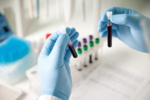 functional lab testing in Litchfield County CT